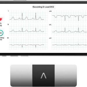 KardiaMobile 6-Lead Personal EKG Monitor – Six Views of The Heart – Detects AFib and Irregular Arrhythmias – Instant Results in 30 seconds – Works with Most Smartphones - FSA/HSA Eligible