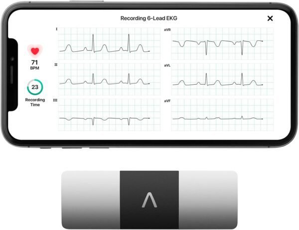 KardiaMobile 6-Lead Personal EKG Monitor – Six Views of The Heart – Detects AFib and Irregular Arrhythmias – Instant Results in 30 seconds – Works with Most Smartphones - FSA/HSA Eligible